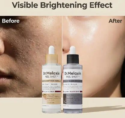 Skin Renewal & Glow Treatment